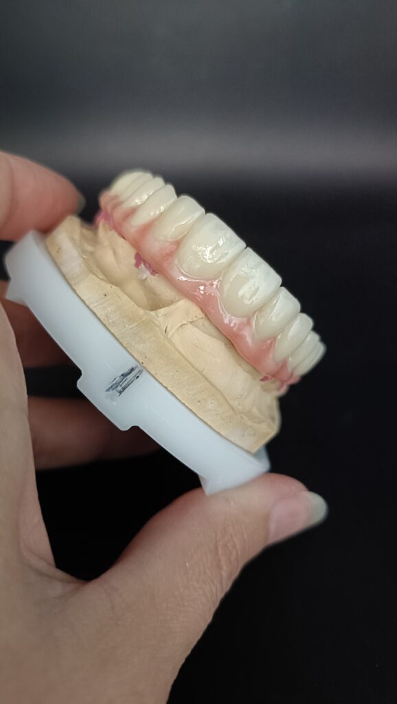 Trabajos prótesis dental