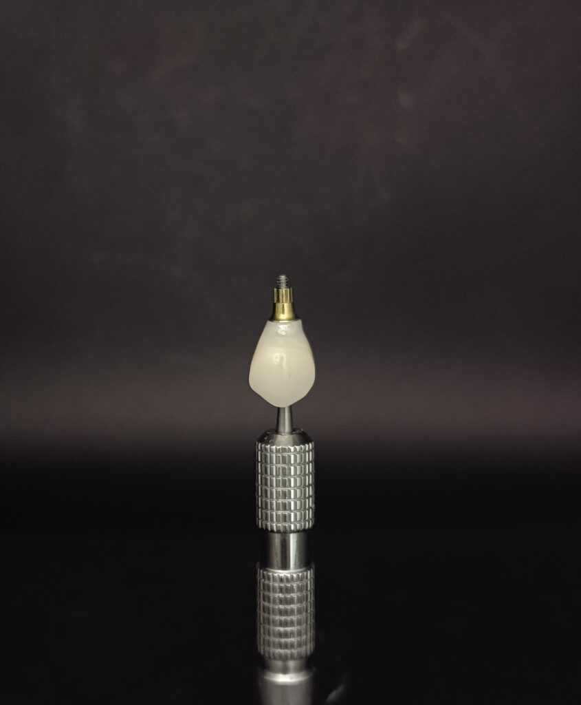 Trabajos prótesis dental