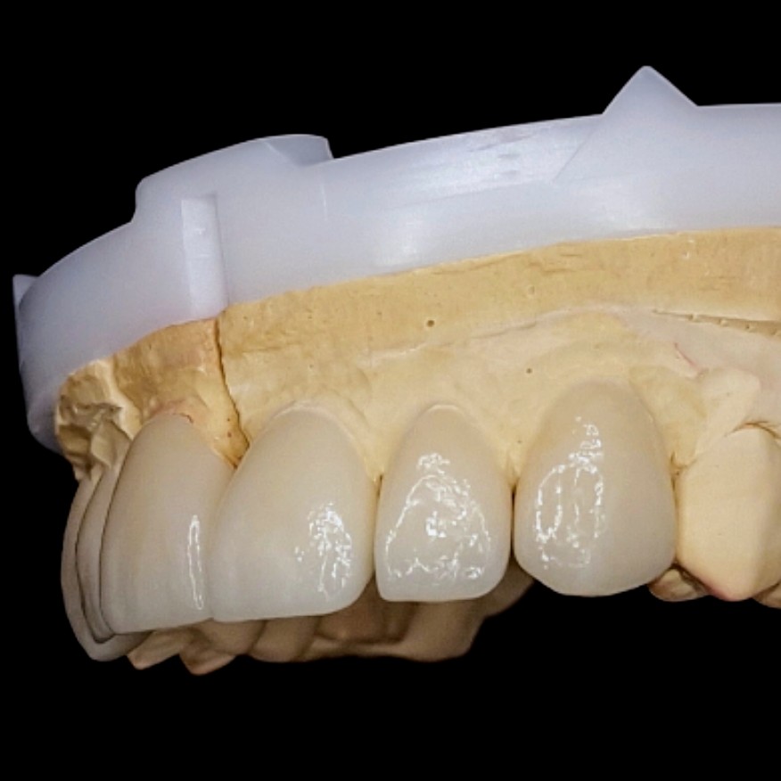 Trabajos prótesis dental