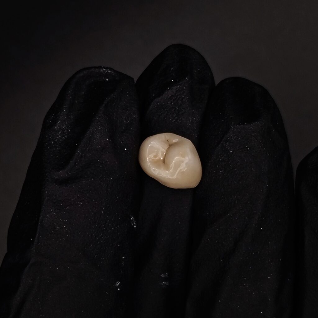 Trabajos prótesis dental