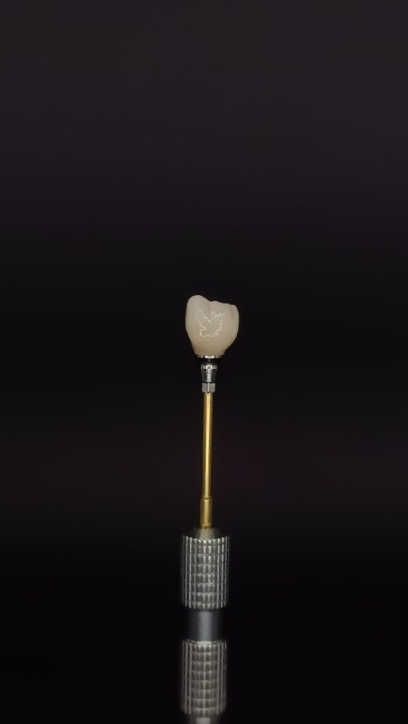 Trabajos prótesis dental