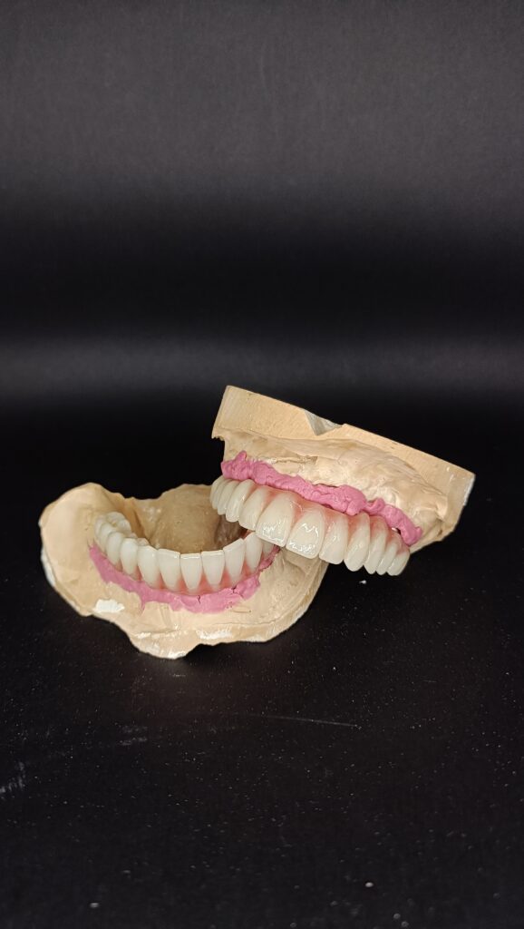 Trabajos prótesis dental