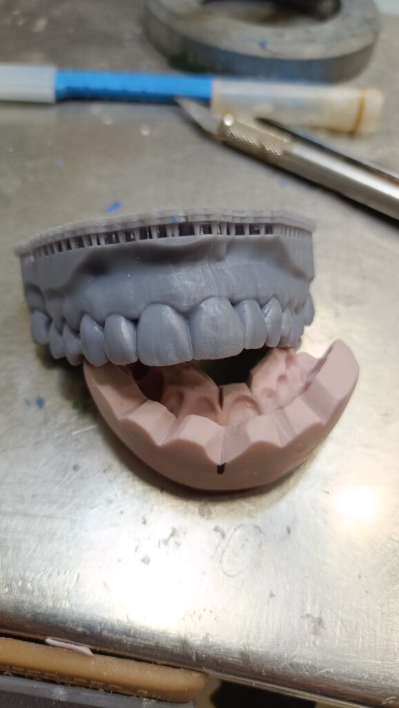 Trabajos prótesis dental