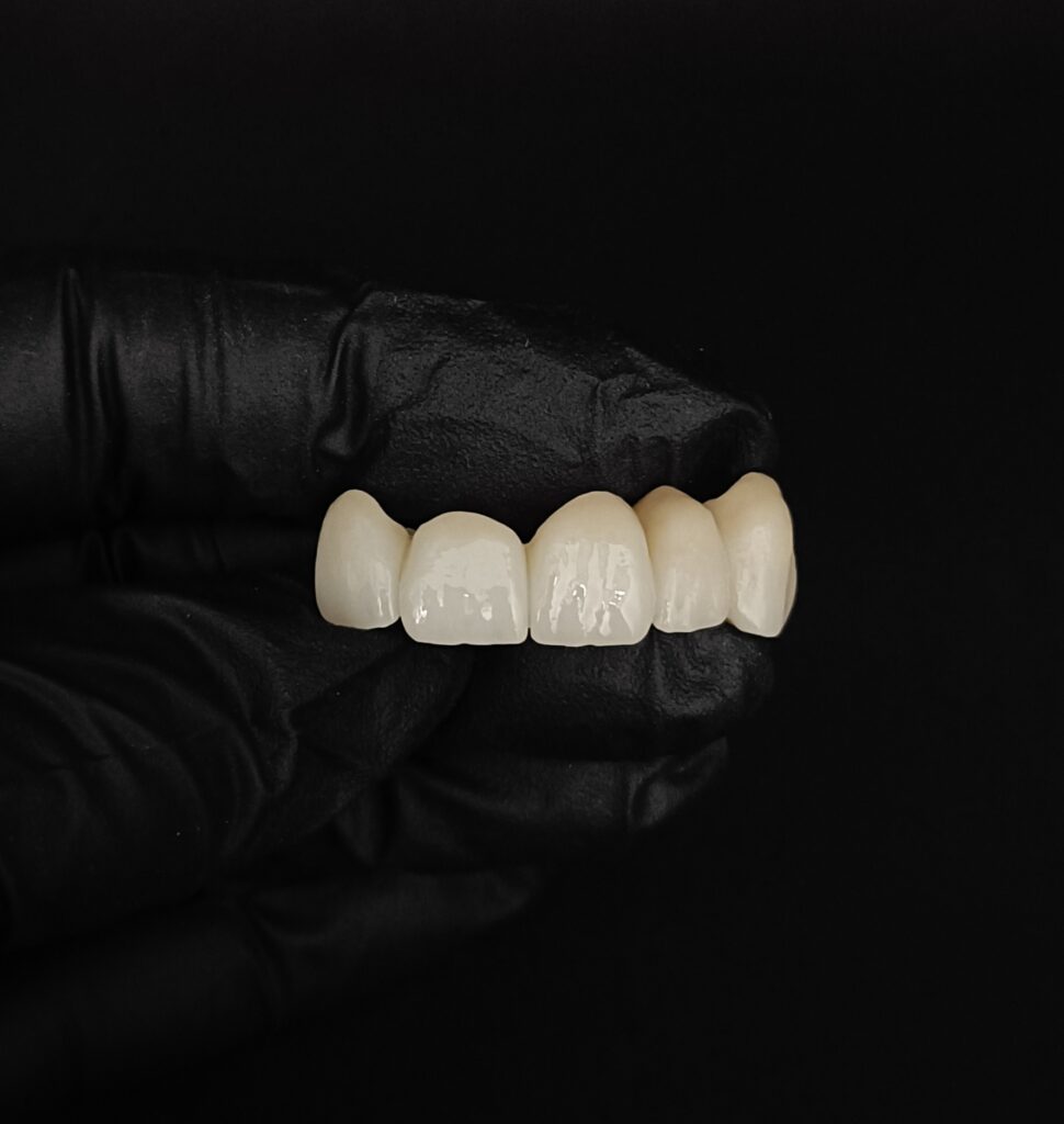 Trabajos prótesis dental