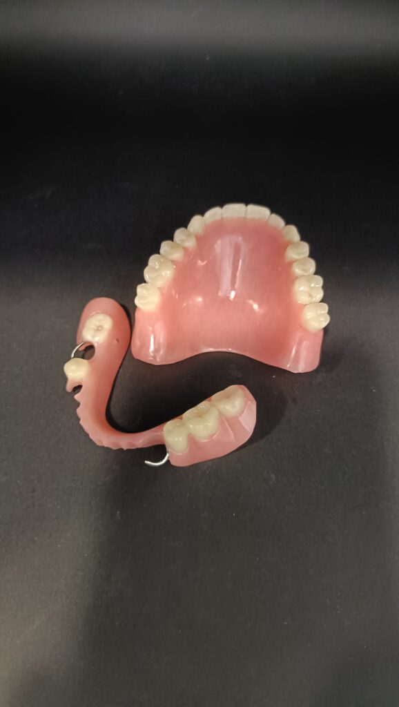 Trabajos prótesis dental