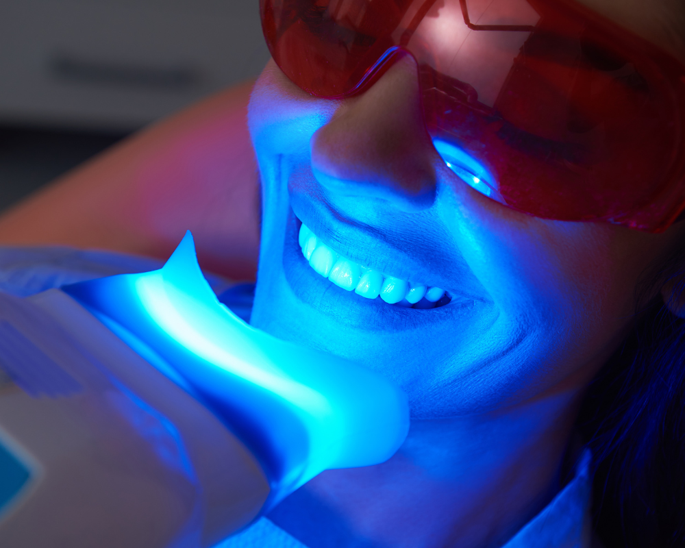 Blanqueamiento dental