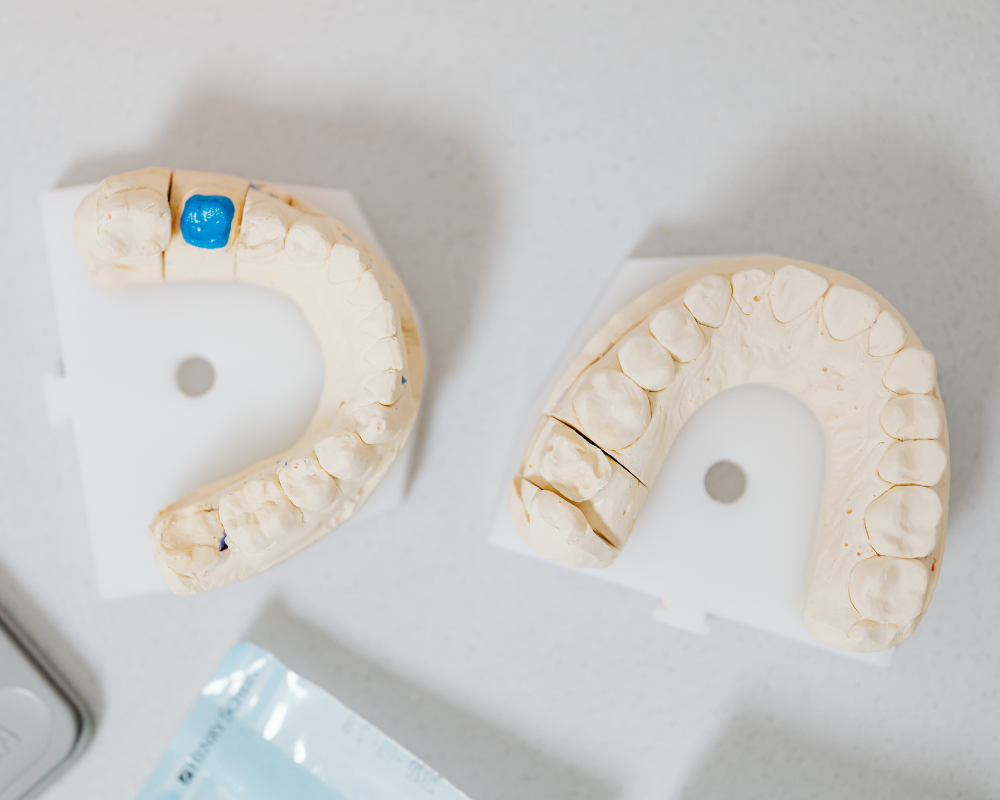 Trabajos prótesis dental