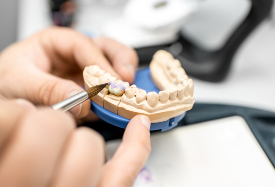 Trabajos prótesis dental