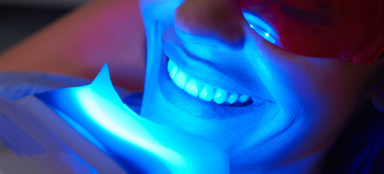 Blanqueamiento dental