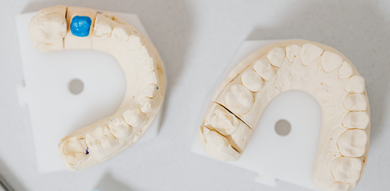 Trabajos prótesis dental